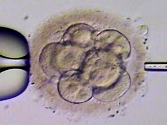 Laser Assisted Embryo Hatching Treatment in Noida Process