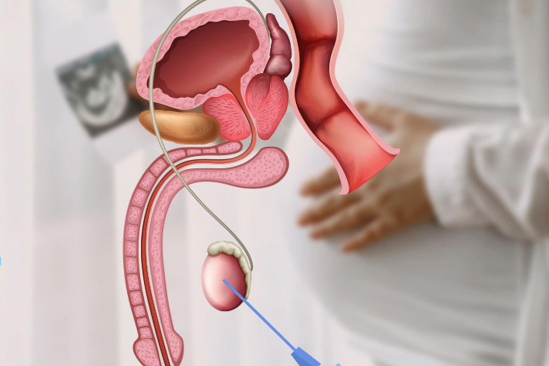 Micro TESE / TESA Treatment in Noida Specialist