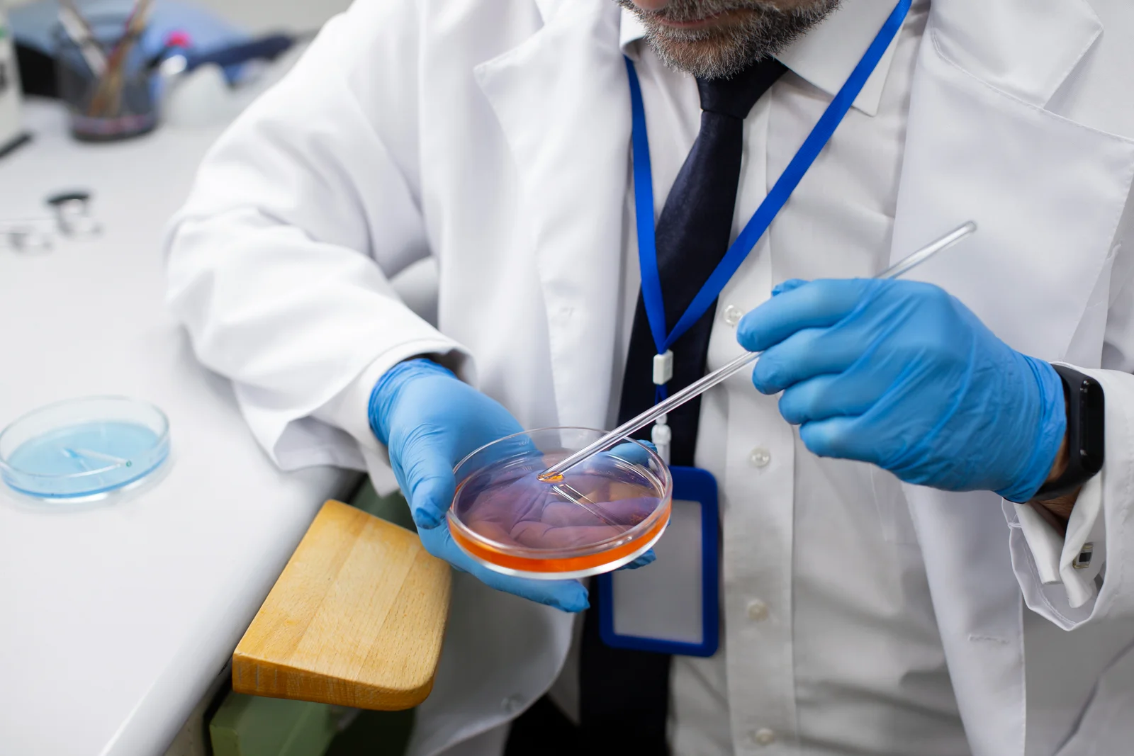 Oligospermia Treatment in Noida Specialist